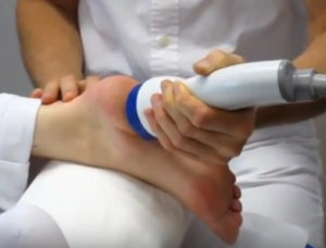 https://softwave-therapy.net/wp-content/uploads/2022/11/the-best-shockwave-therapy-machine.jpeg